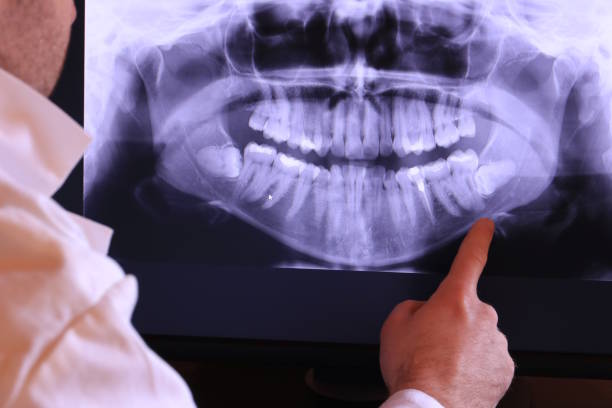 Best Mobile Emergency Dentist in Walterboro, SC